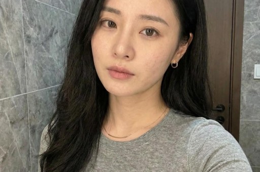 这几位内娱明星可太糗了来扒一扒伤口